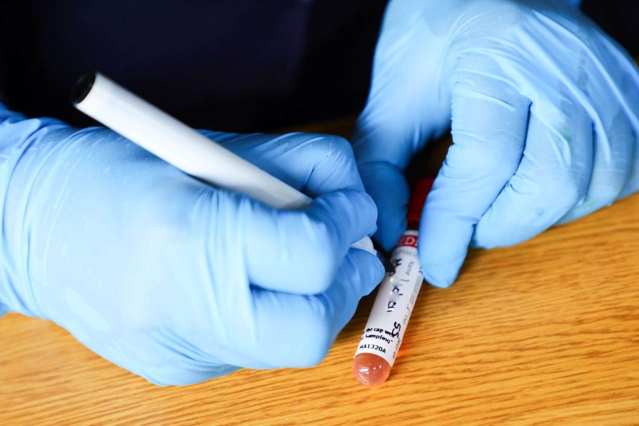 Salud traslada hoy la jornada de realización de pruebas para detectar el COVID19 en San Marcos salud-traslada-hoy-la-jornada-de-realizacion-de-pruebas-para-detectar-el-covid19-en-san-marcos